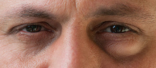 Soins anti-poches