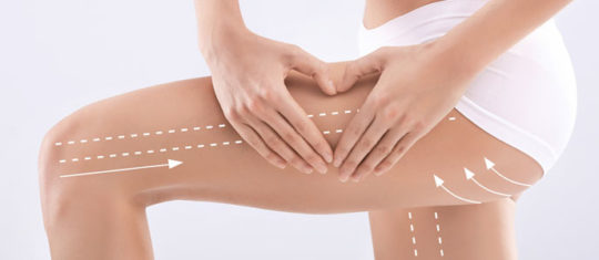 Chirurgie esthétique